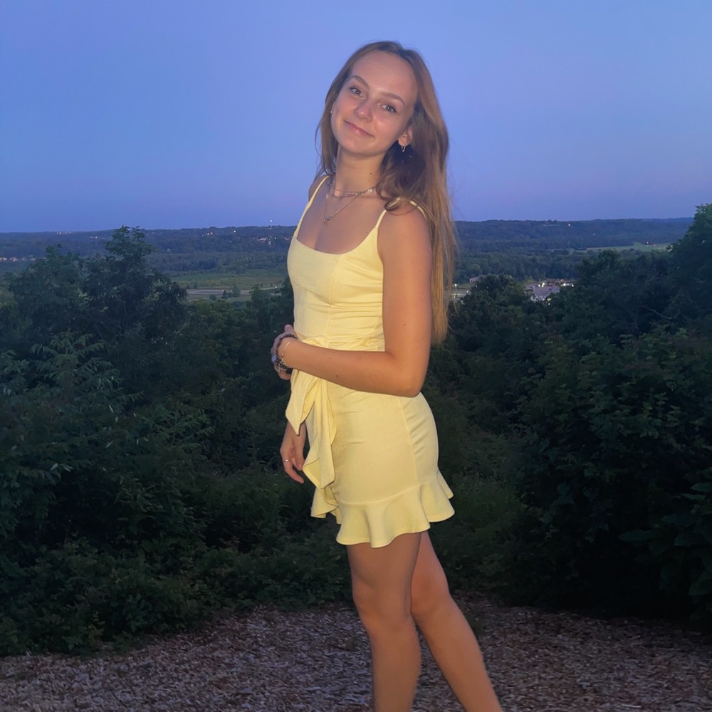 Lucy in the Sky yellow wrap dress so cute!